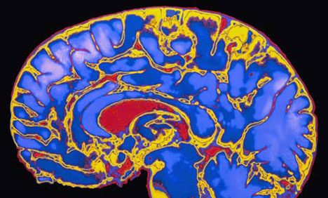 Brain scans show leaps in 'coma' science