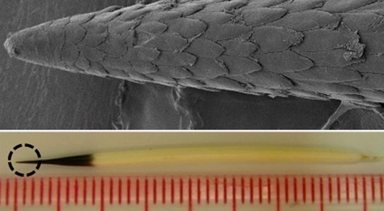 Barbed Porcupine Quills Could Help Enhance Various Biomedical Devices